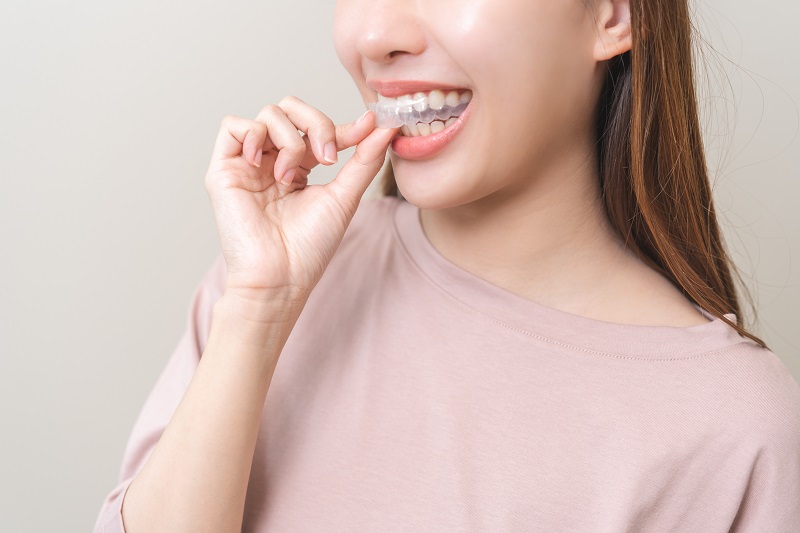 Prostowanie zębów bez aparatu – możliwe czy nie?